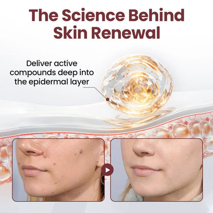 Alcuras™ KeraErase Dual-Action Renewal Cream